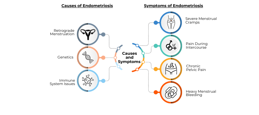 Causes and Symptoms of Endometriosis