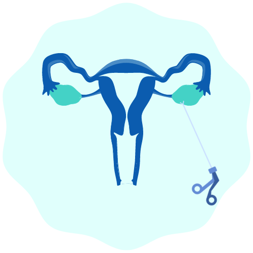 Laparoscopy And Hysteroscopy