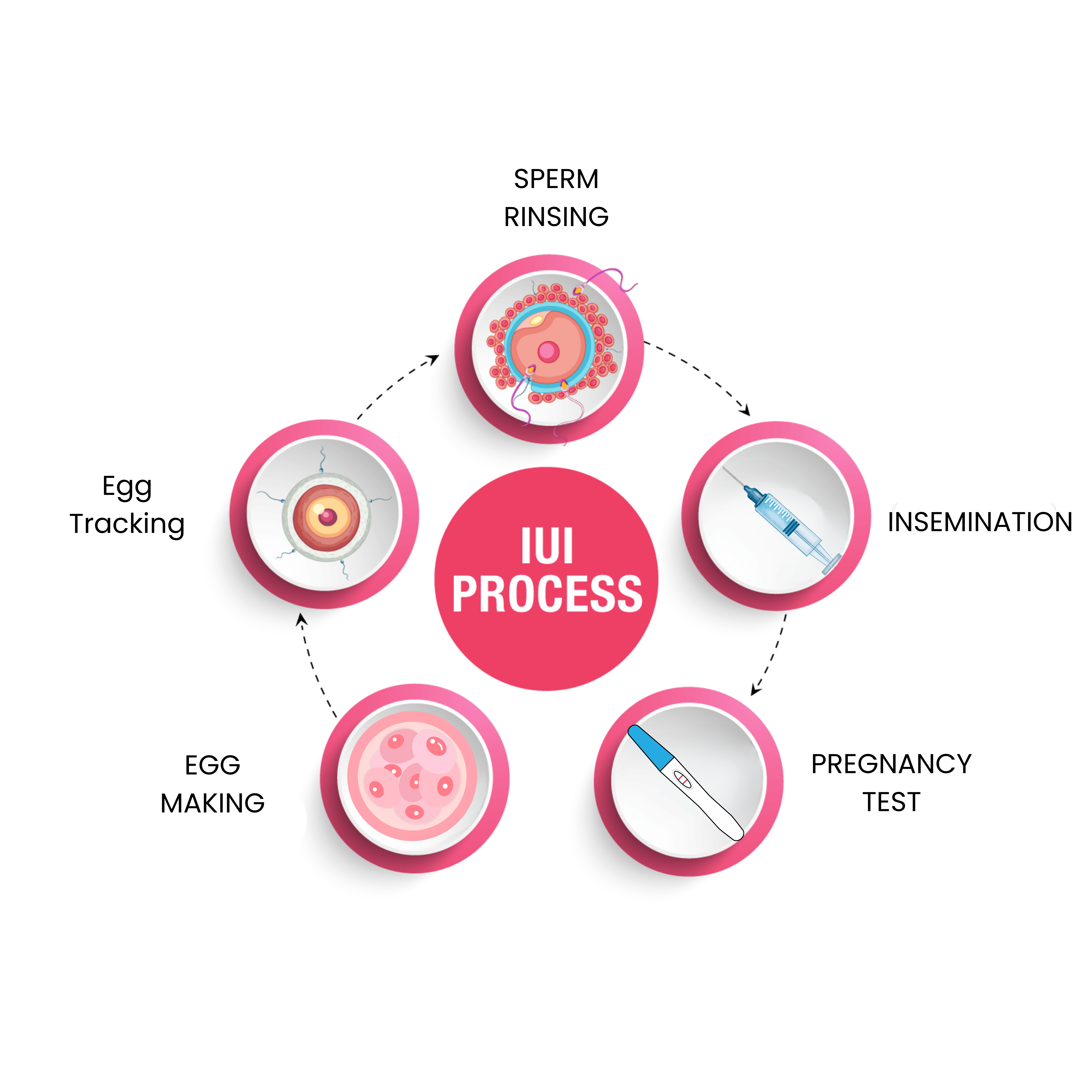 The IUI Process