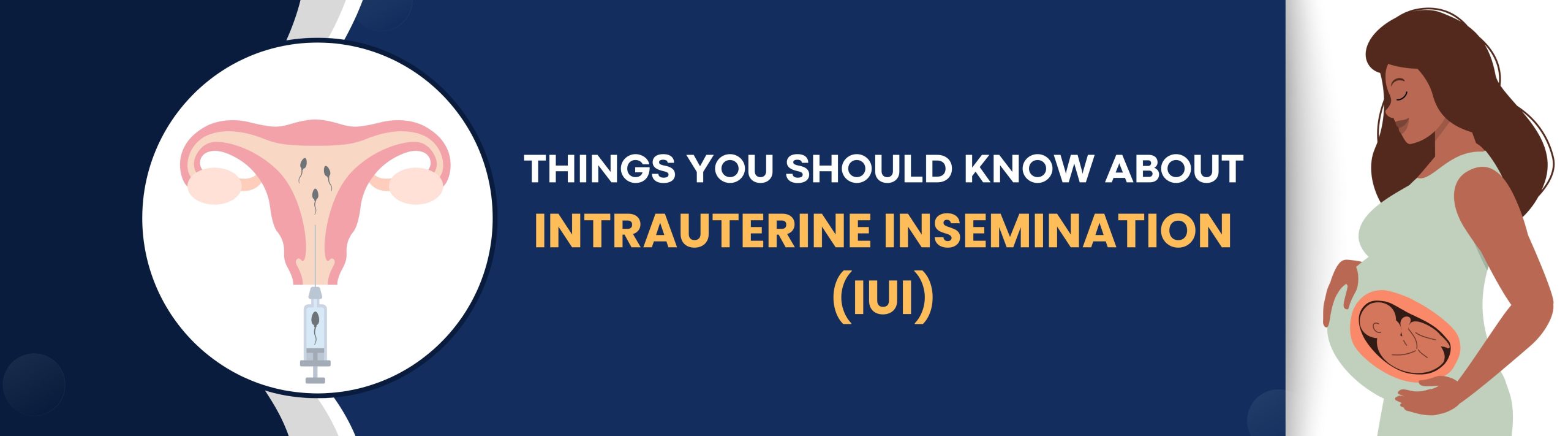 Things You Should Know About Intrauterine Insemination (IUI)