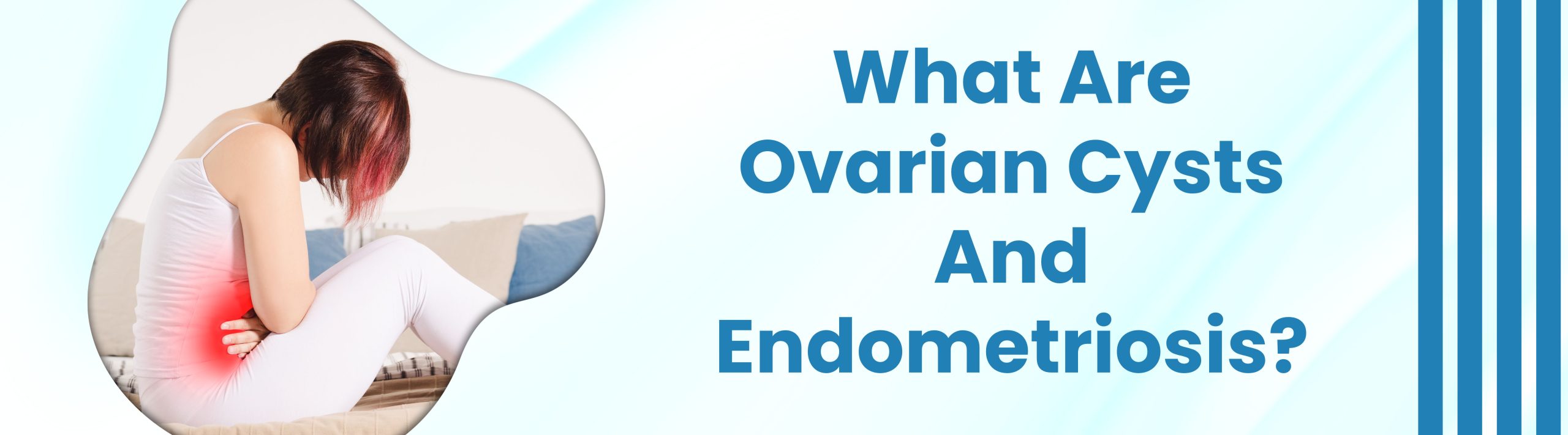 What Are Ovarian Cysts And Endometriosis?